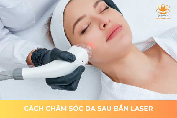 Cách Chăm Sóc Da Sau Bắn Laser